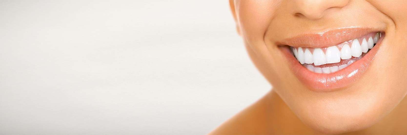 porcelain veneers | Arvada, CO
