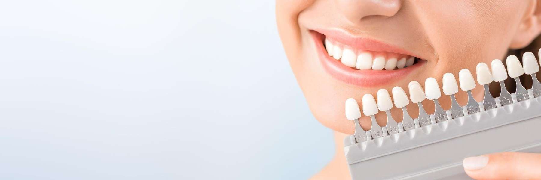 teeth shades in Arvada CO
